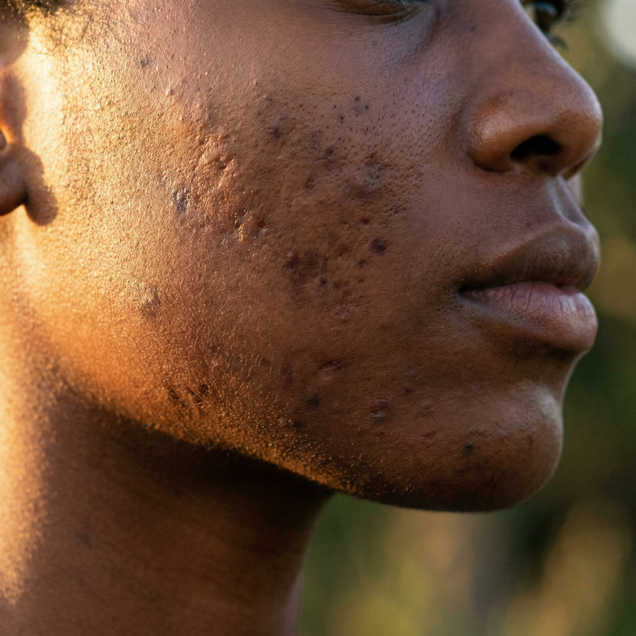 Supports Skin Renewal & Recovery