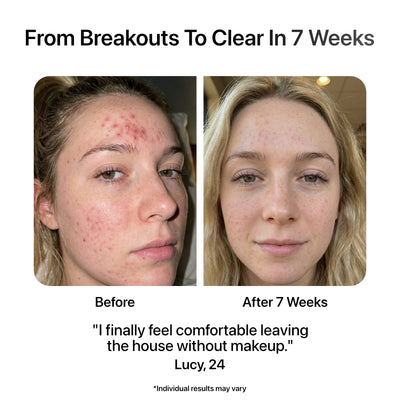 Before and after results using Plasmour Ion Pro