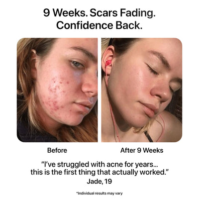 Before And After Using The Ion Pro Review