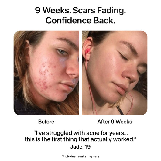 Before And After Using The Ion Pro Review