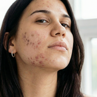 Skin Renewal & Recovery